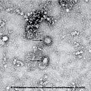 好消息!中国疾控中心开始研发新型冠状病毒疫苗