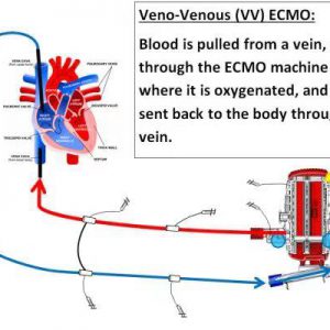 支援武汉,精准捐献:加拿大白求恩医学发展协会在行动